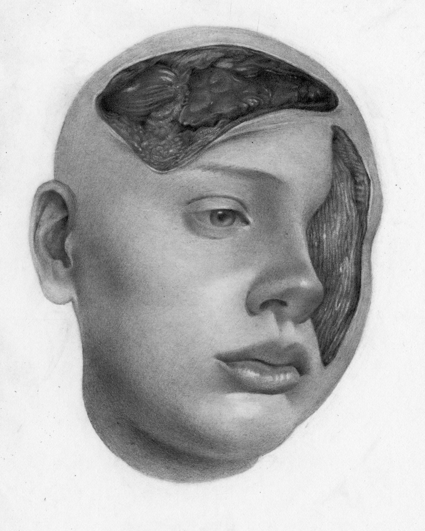 Michael Powers Tarantelli - Surgery Head